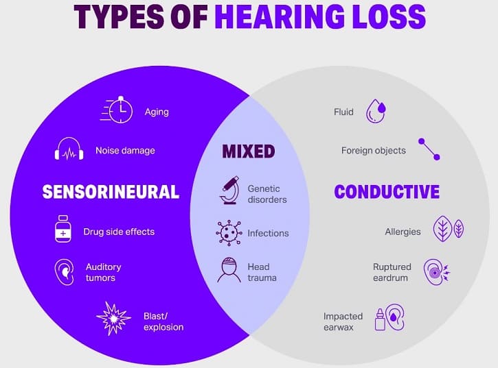 types of Hearing Loss